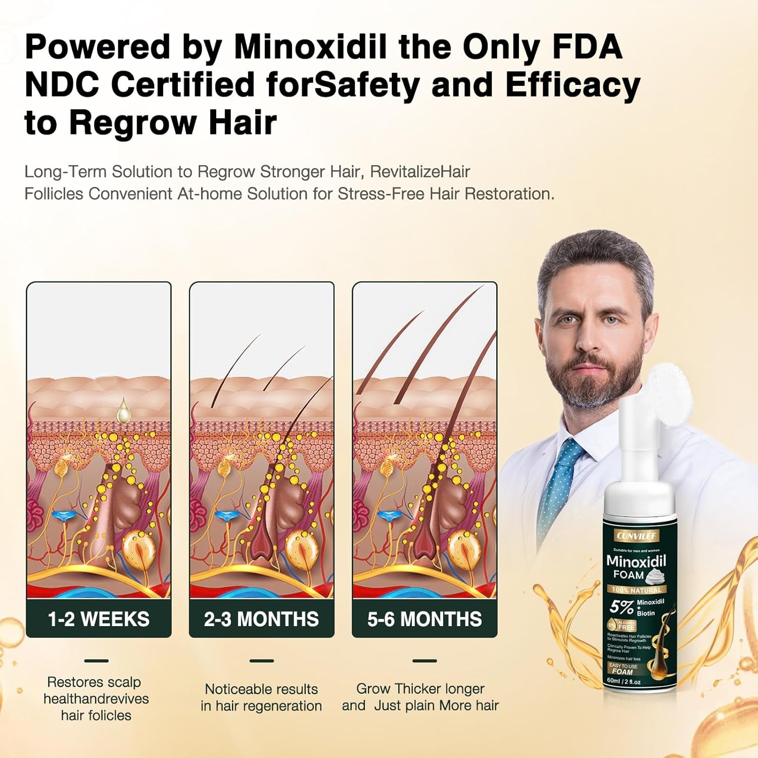 5% Minoxidil Foam for Men and Women Hair Growth, Slows Hair Loss and Promotes Hair Regrowth Treatment for Women and Men, Thicker Hair(6.33Oz Pack of 3)