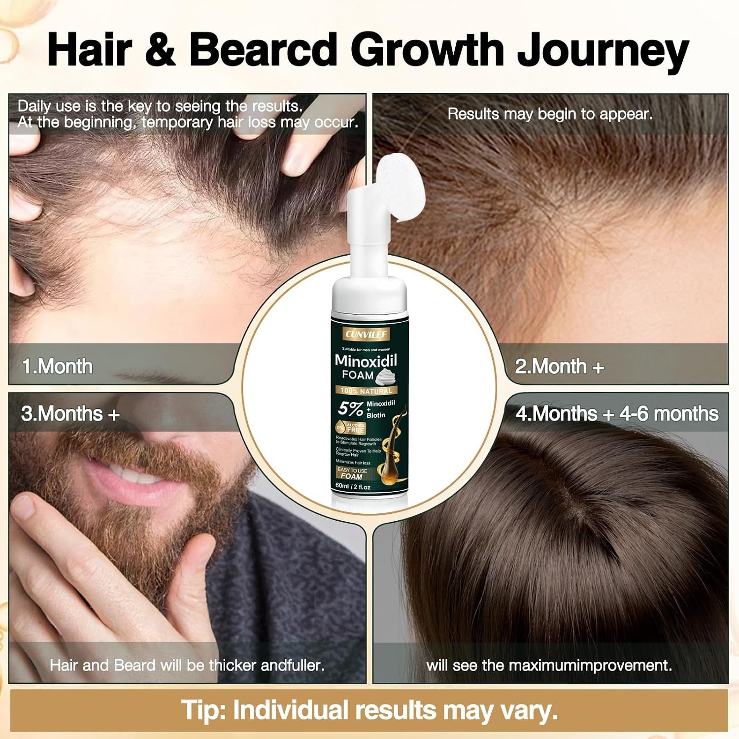 5% Minoxidil Foam for Men and Women Hair Growth, Slows Hair Loss and Promotes Hair Regrowth Treatment for Women and Men, Thicker Hair(6.33Oz Pack of 3)